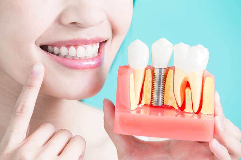 周りに気づかれずに歯並びを治したい