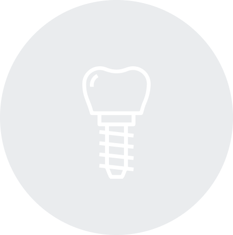 インプラント治療