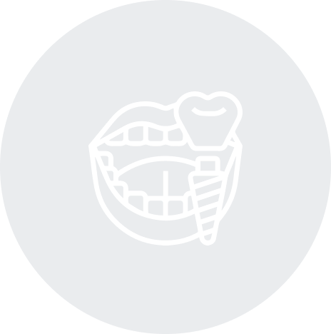 抜歯即時インプラント