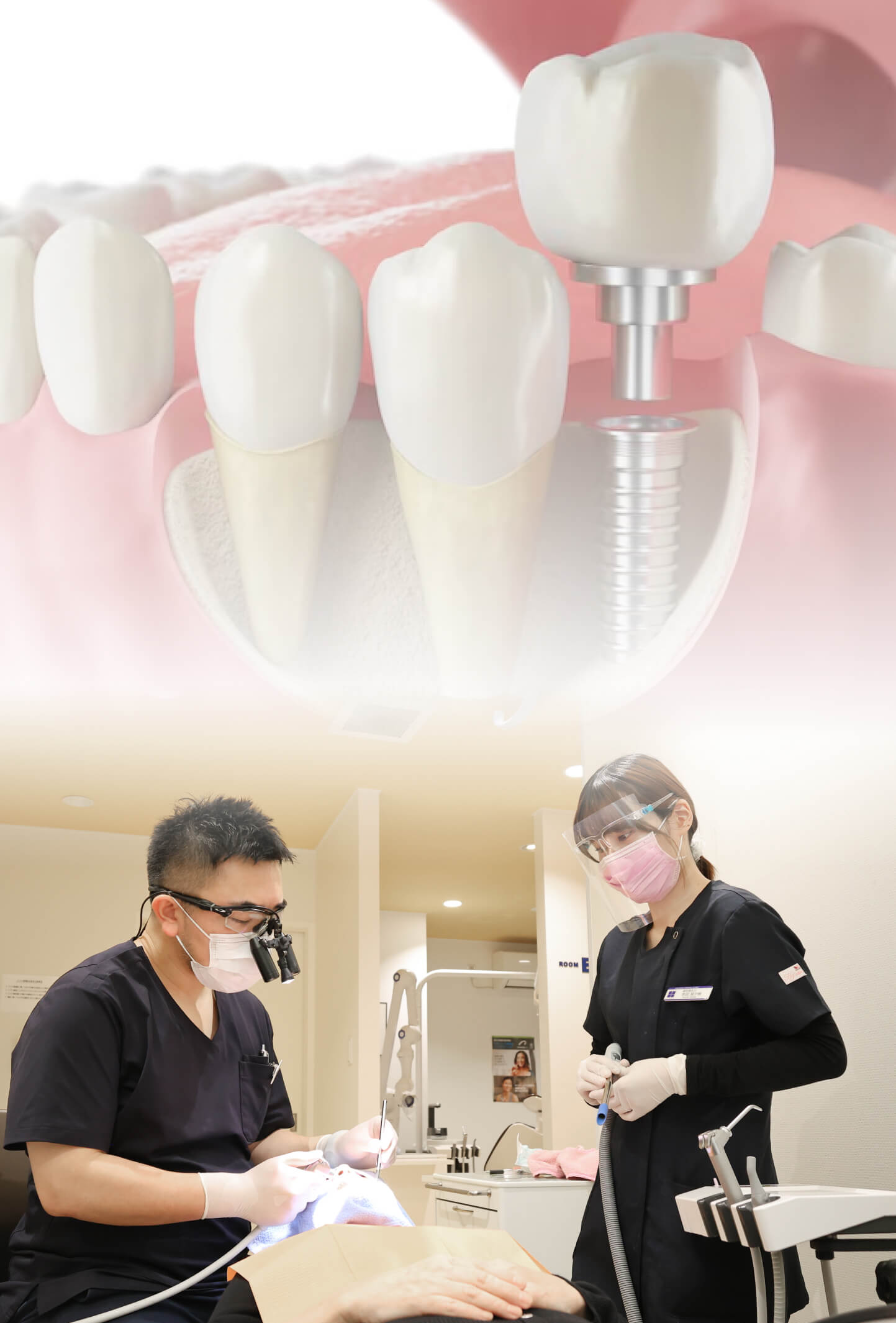 抜歯即時インプラント